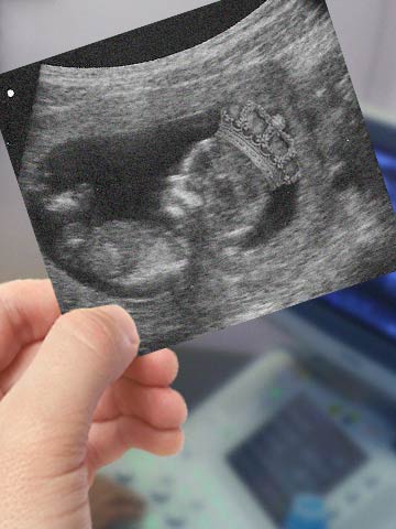 Pregnant Kate Middleton and Prince William's baby - first scan pic!