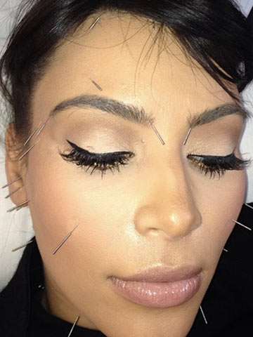 Eeek! Pregnant Kim Kardashian shows off face full of needles