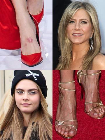 Celebrity feet - who's got weird toes?