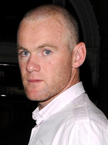 OMG! Wayne Rooney shows off shaved head after having second hair transplant