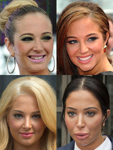 OH GOD! Tulisa Contostavlos admits to 'face-lift' treatments - now